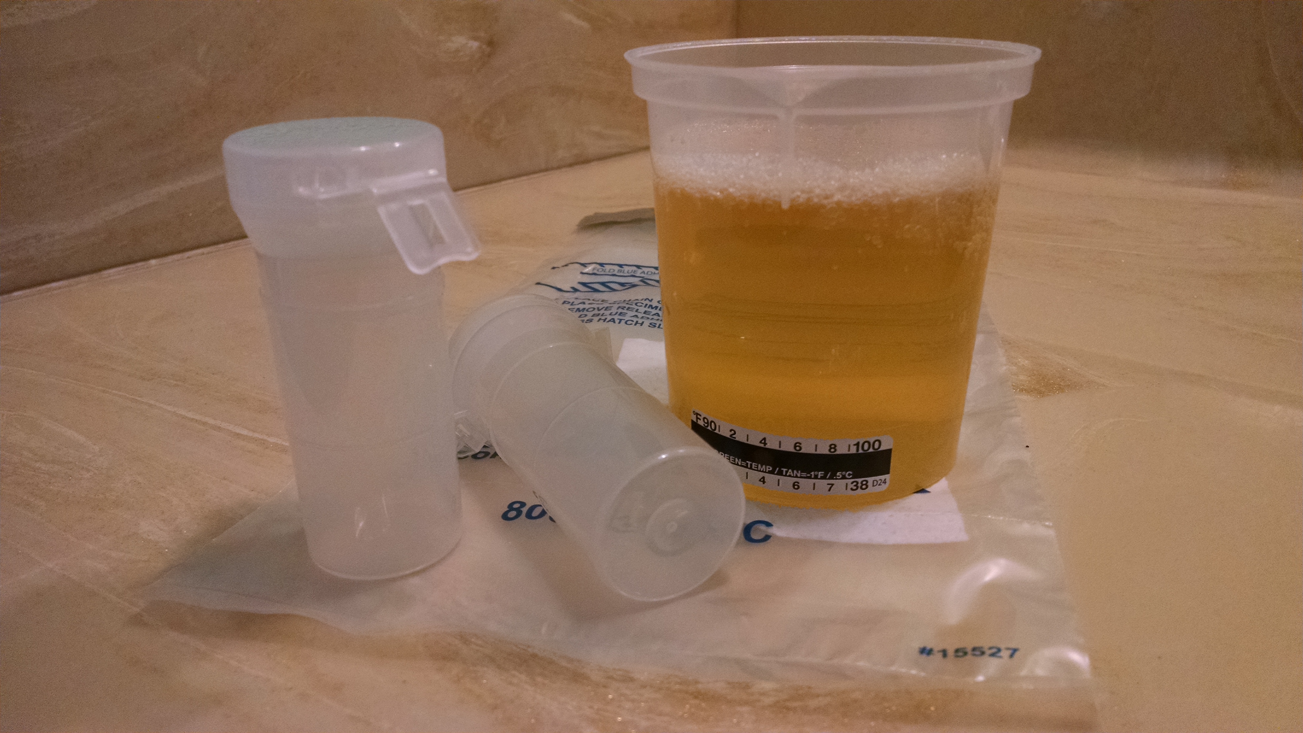 Negative Dilute Drug Test >> NEGATIVE DILUTE FACT SHEET - AMC Online Negative Dilute Drug Test >> NEGATIVE DILUTE FACT SHEET - AMC Online